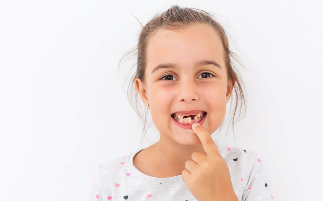 What to Expect if Your Child Needs a Tooth Extraction