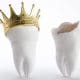 dental crown