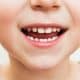 fluoride-and-child-development-what-parents-need-to-know
