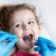 the-surprising-impact-of-baby-teeth-on-your-childs-development