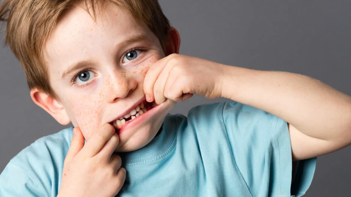 what-to-do-when-your-child-knocks-out-a-tooth