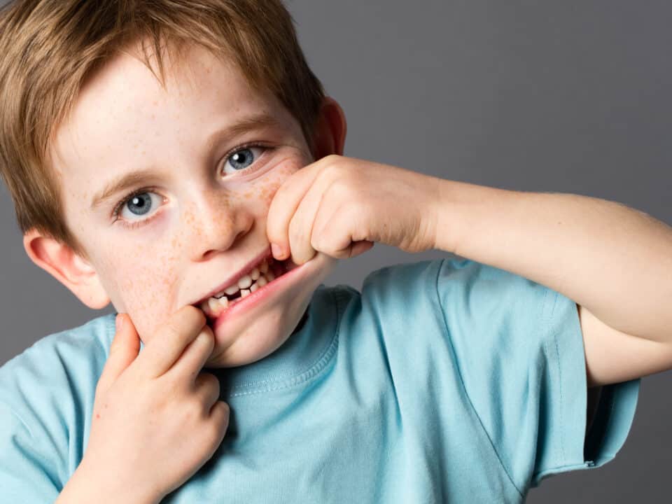 what-to-do-when-your-child-knocks-out-a-tooth